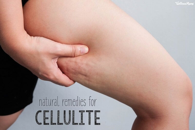 how to fix cellulite