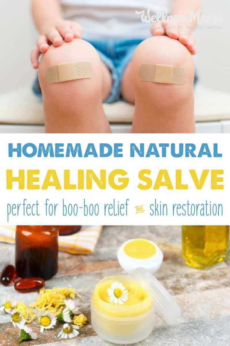 This natural healing salve is a chemical free alternative to antibiotic ointments and has herbs to help prevent infection.